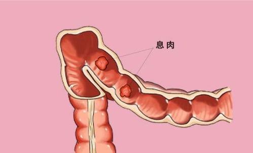 һ�������̲��׵ð�֢