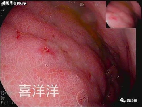 赤峰癌症乐园_赤峰肿瘤医院预约电话号码 赤峰癌症乐园_赤峰肿瘤医院预约电话号码