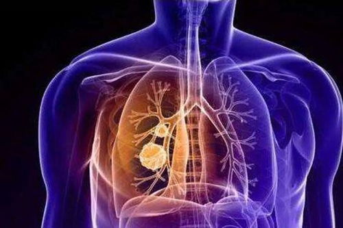 ��֢����ʲô���� ��֢��������ʲô