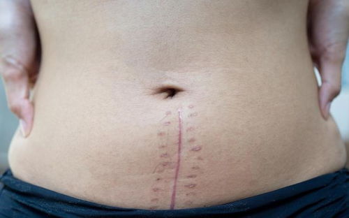 ��֢���ջ��ܳԸ�ðҩ��