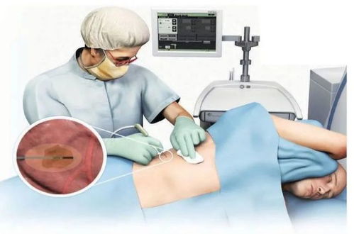 宝宝吃什么容易得癌症的 宝宝吃什么容易得癌症的