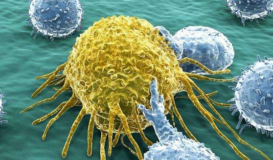 ������֢����_������֢ct���ĳ�����