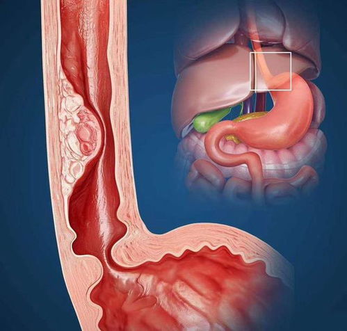 ��֢�Ը��� ��֢���߳Է������