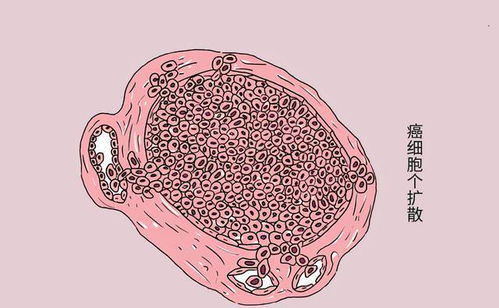 ���˵ð�֢ ���˵ð�֢������С���й�ϵ��