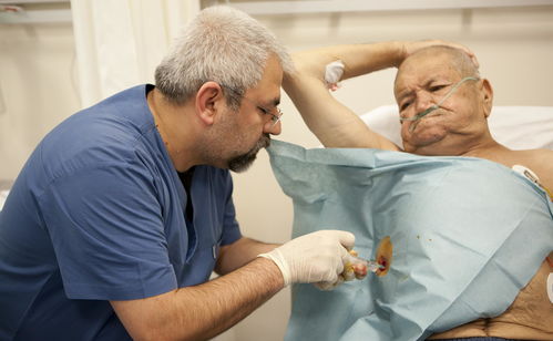 癌症是指全部癌症吗 癌症到底是 癌症是指全部癌症吗 癌症到底是