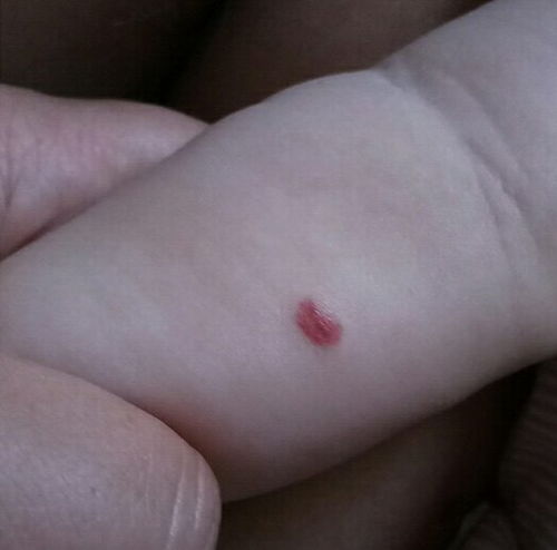 ���㵨��֢ ���������п���������