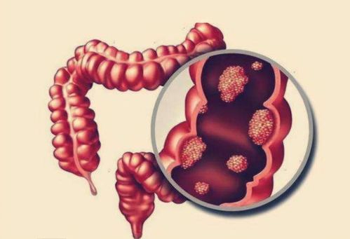 �����갩֢���������а�