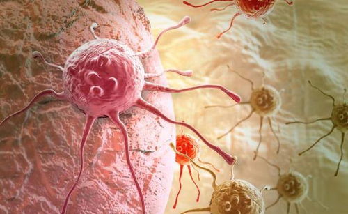 癌症发病最多的是啥时候 癌症发病最多的是啥时候