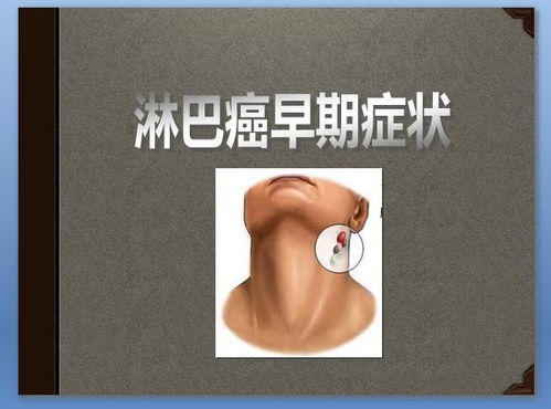 �°氩֢���� ��֢����ָ��