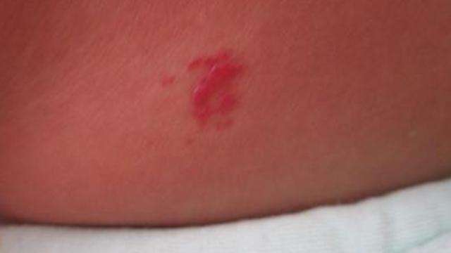 ���ֲ˲���Ԥ����֢��