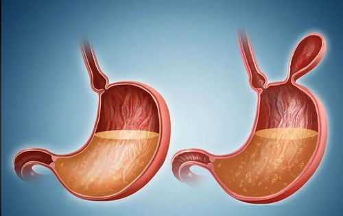 腿上鼓包一按疼是癌症 腿上鼓包一按疼是癌症