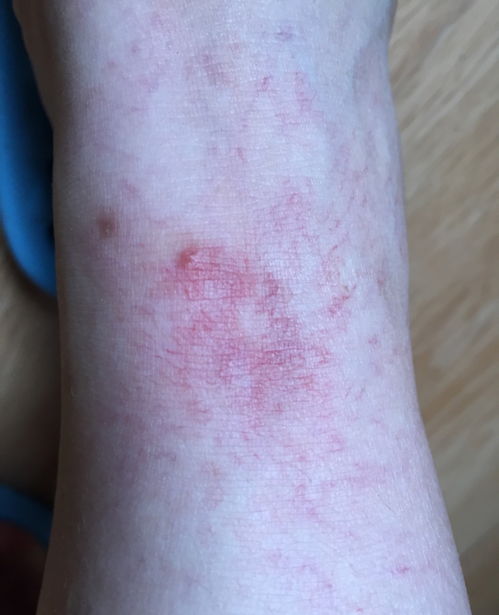 癌症即将消亡 癌症消失 癌症即将消亡 癌症消失