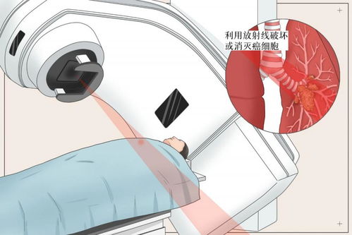 һ���һ�������ǰ�֢��