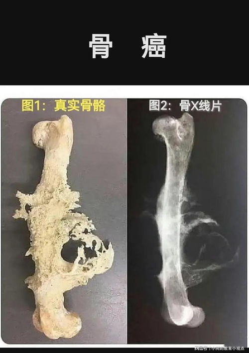 癌症要不要拍全家福照 癌症要不要拍全家福照