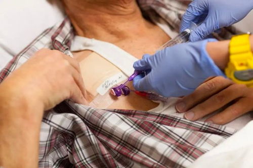 ��֢���˿��Ժȴ���ˮ��