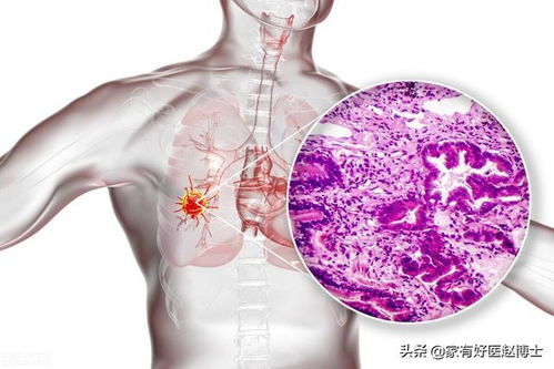 45����Ҫ���ʲô��֢