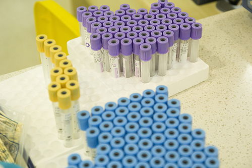 任何癌症都可以化疗吗 任何癌症都可以化疗吗