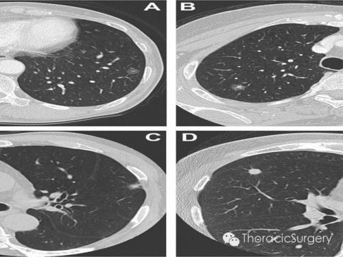 ��֢��Ҫ������ȷ����