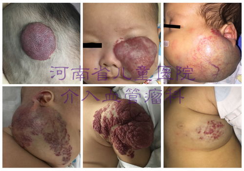 刘嘉玲消失照片_刘嘉玲29年前旧照 刘嘉玲消失照片_刘嘉玲29年前旧照