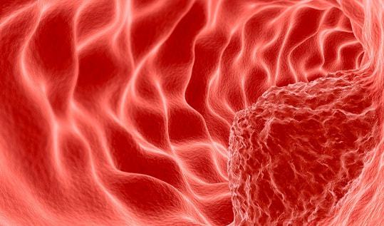 0-60岁癌症发病率 癌症年龄发生率 0-60岁癌症发病率 癌症年龄发生率