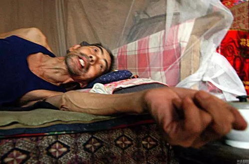 日本的癌症 日本的癌症治愈率是多少 日本的癌症 日本的癌症治愈率是多少