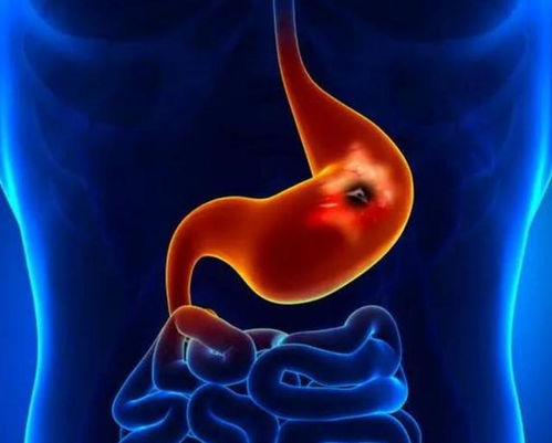 翟天临是谁 翟天临是zhai还是di 翟天临是谁 翟天临是zhai还是di