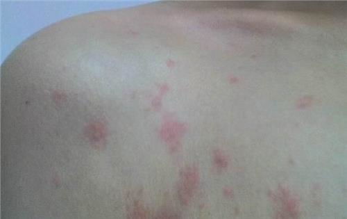 ��֢�����ܳԲ�������