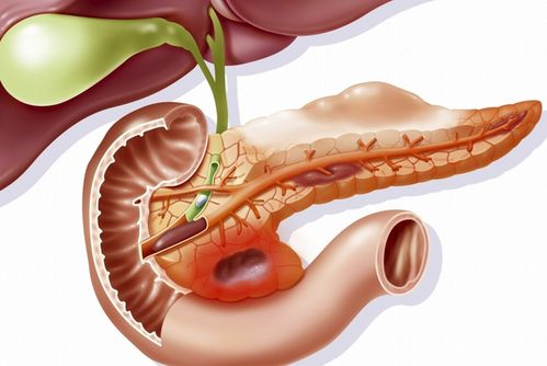 �μ���֢�������μ���֢���˲����ת