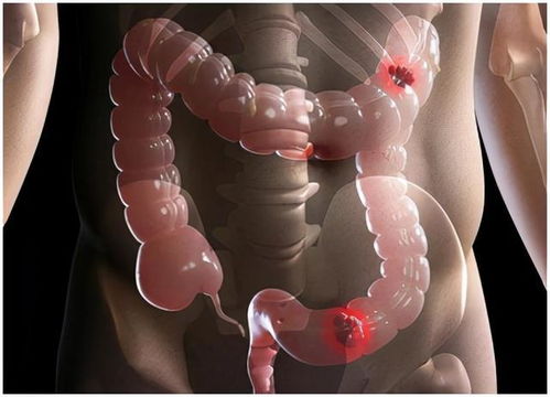 ��ֻ֢�������һ����