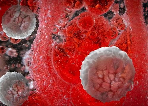 癌症病人甲胎蛋白增加数 癌症病人甲胎蛋白增加数