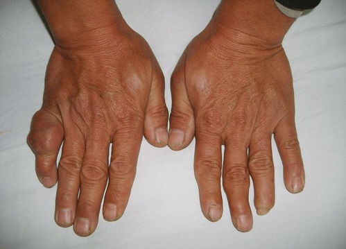 ���֢���(���������)