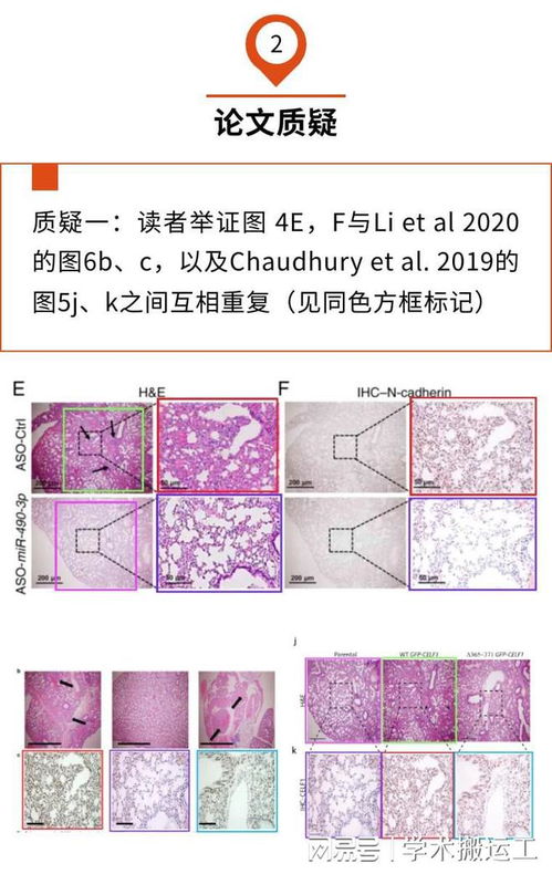 ƫ���ΰ�֢�� �ΰ�֢��ƫ����