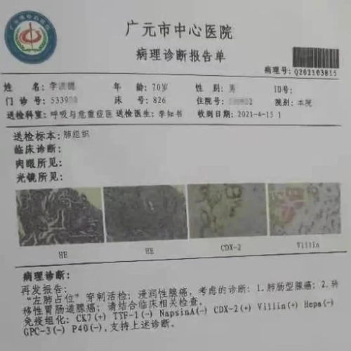 ��ҽ���ܲ����֢�� ��ҽ����ȷ�ﰩ֢��