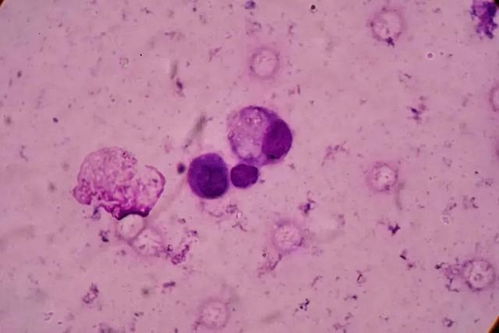 ����ҩ���ΰ�֢�� ����ҩ���ΰ�֢����Ƶ