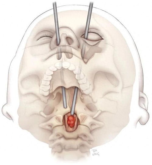 ������С�����ǲ��ǰ�֢